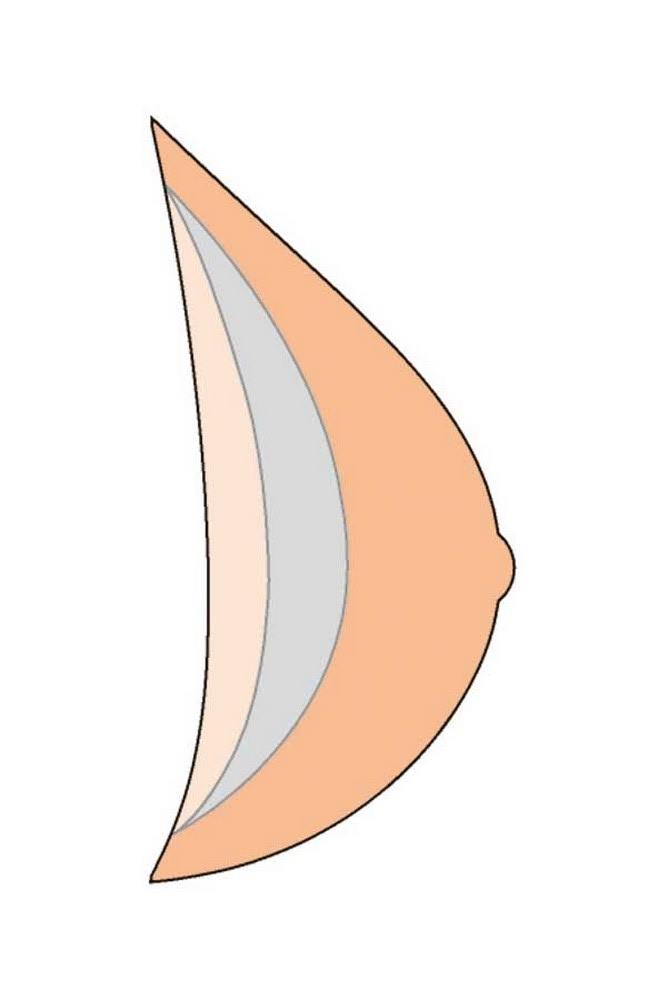 Natura Xtra Light Breast Form Size 8 F8461